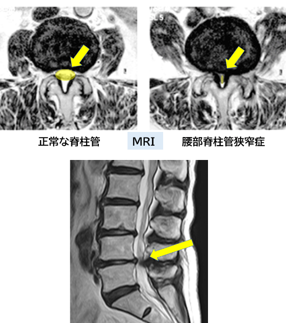 腰の痛み | 西田整形外科クリニック